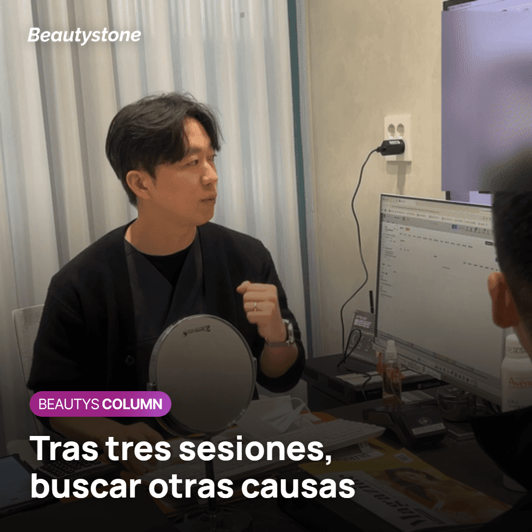 Comparar fotos del entrecejo tras tres sesiones de Botox