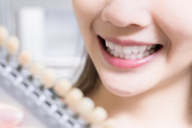 teeth whitening service in hong kong