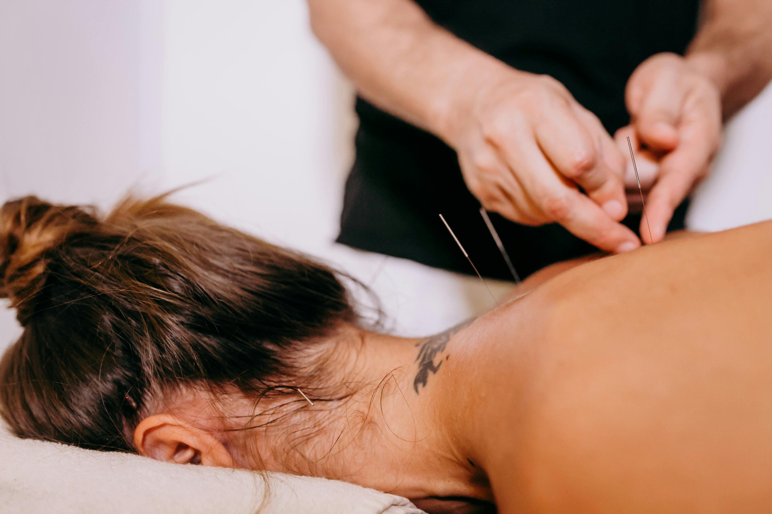 Cosmetic Procedure