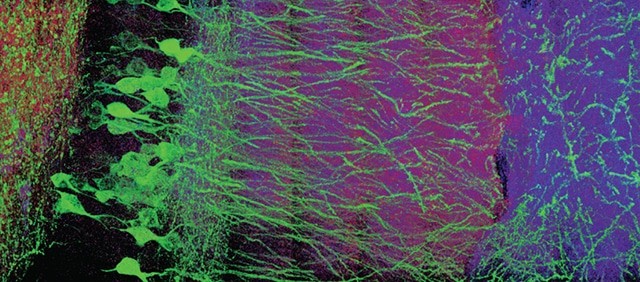 Expansion microscopy