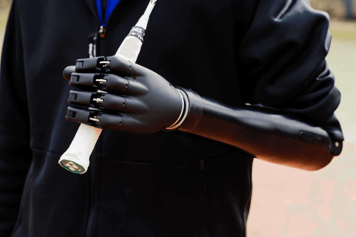 What Makes Daily Power Management Effortless for Bionic Hand Users?