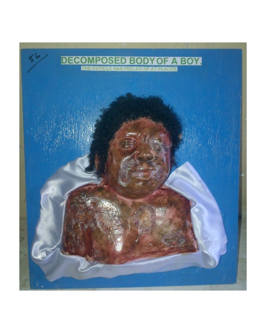 Decomposed Body of a Boy