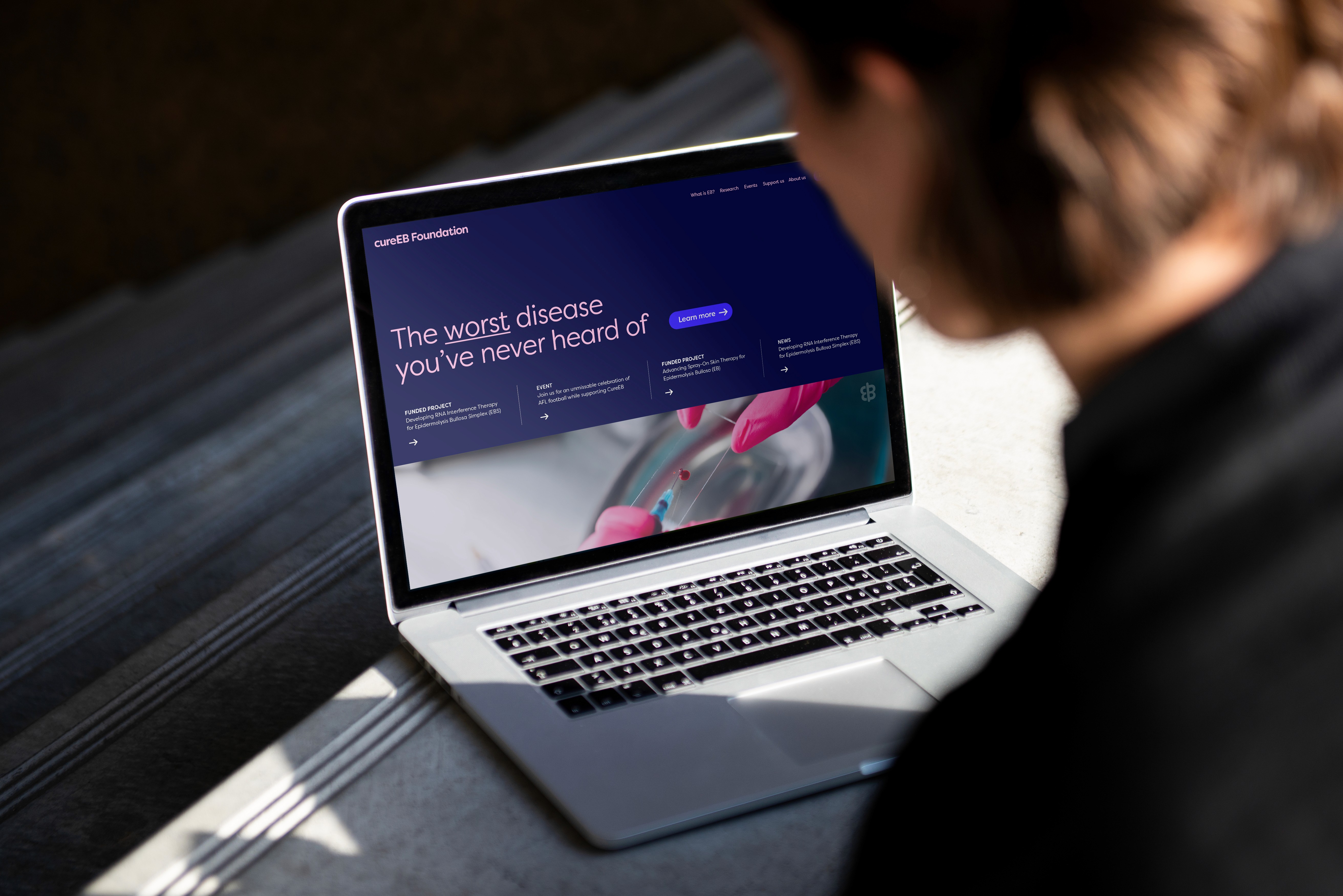 Website for CureEB Foundation