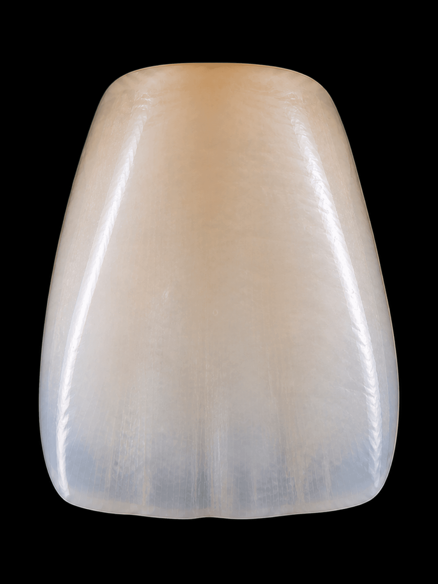 Corona anterior