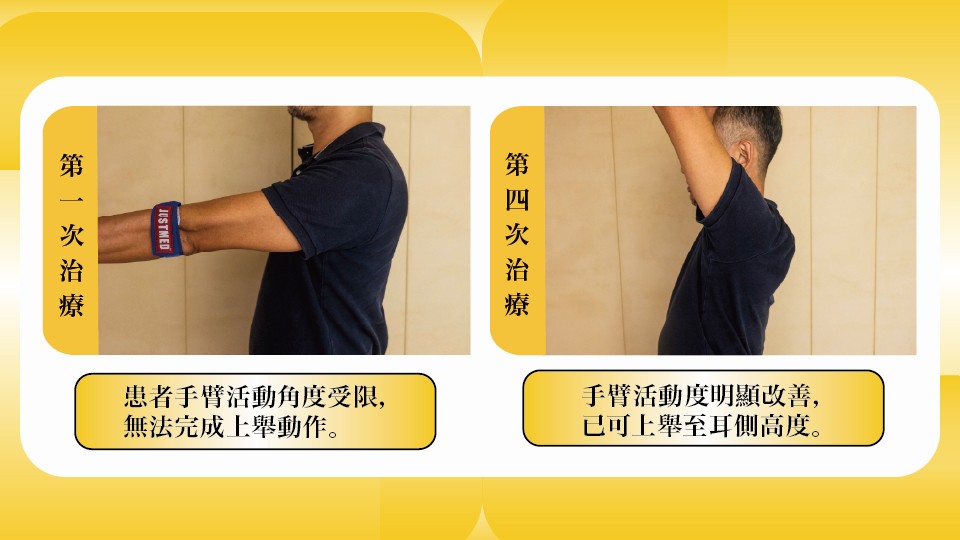 治療前後比較圖