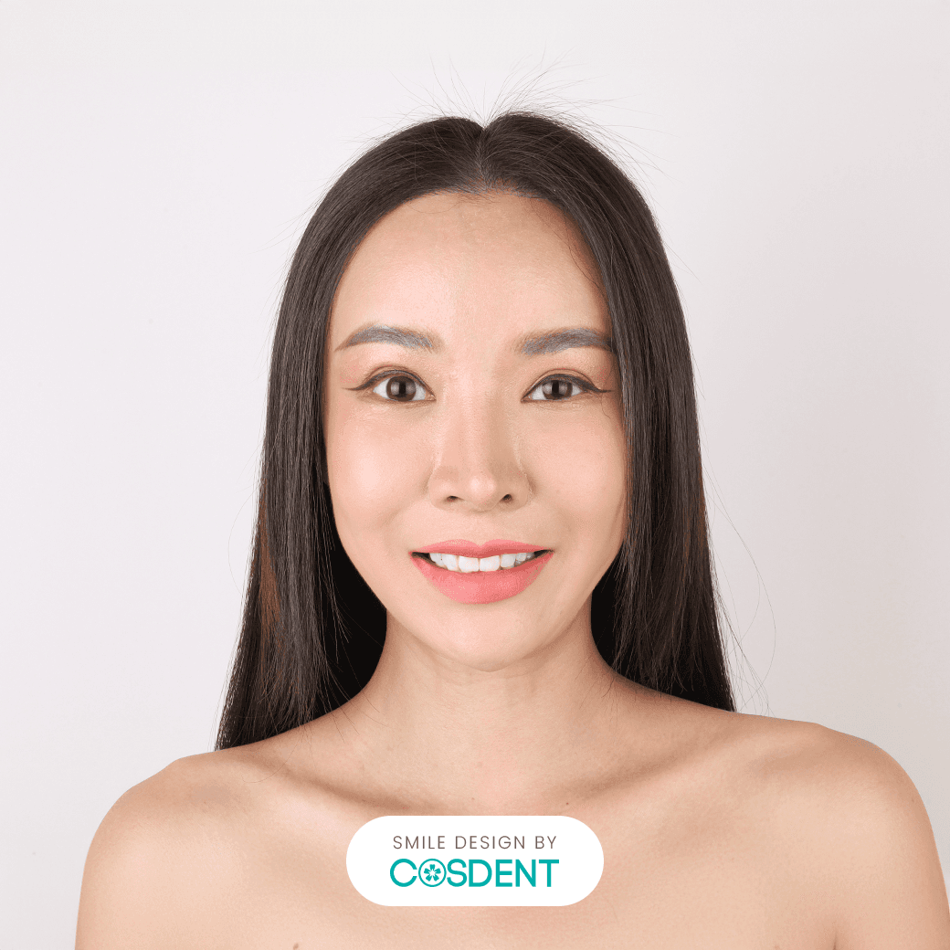 หน้าจีน ยิ้มกว้าง 19 ซี่