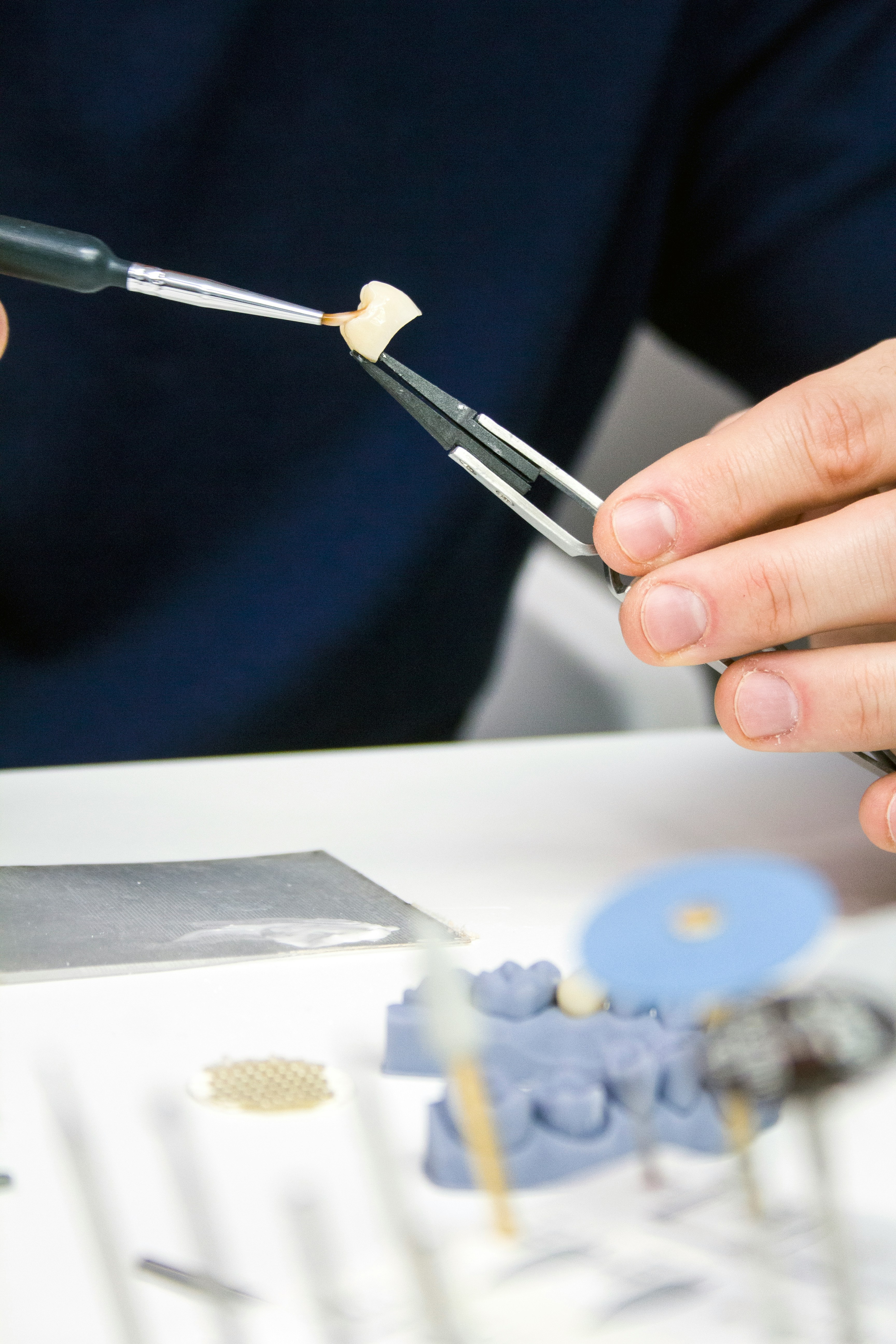 A Midtown Toronto Dentist placing a dental crown at Midtown Dental Studio on Eglinton