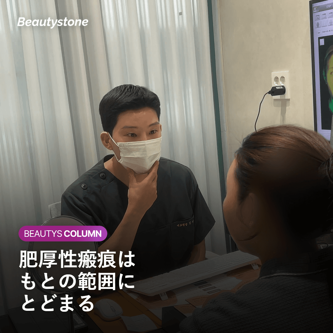 肥厚性瘢痕がもとの範囲にとどまることを示す図
