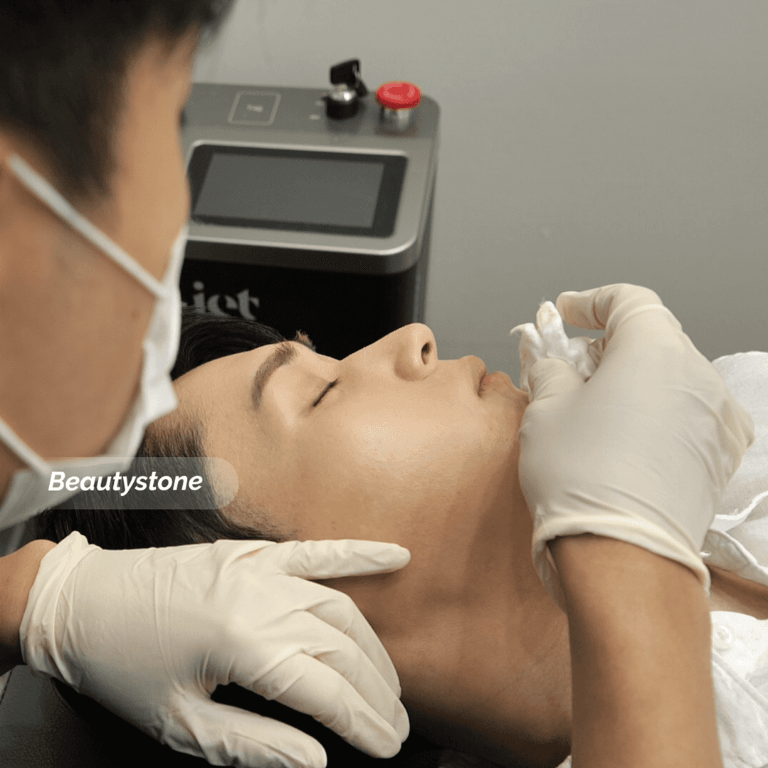 서울 합정 웨딩패키지 피부과 피부 타입별 시술 선택 기준