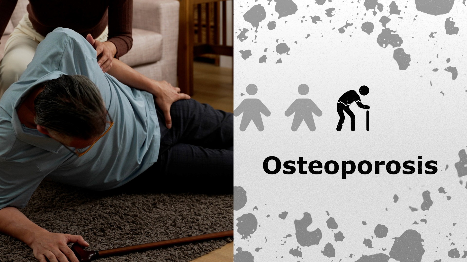 The left and right split images show an old man suffering fractures due to a fall, and the image illustrates osteoporosis.