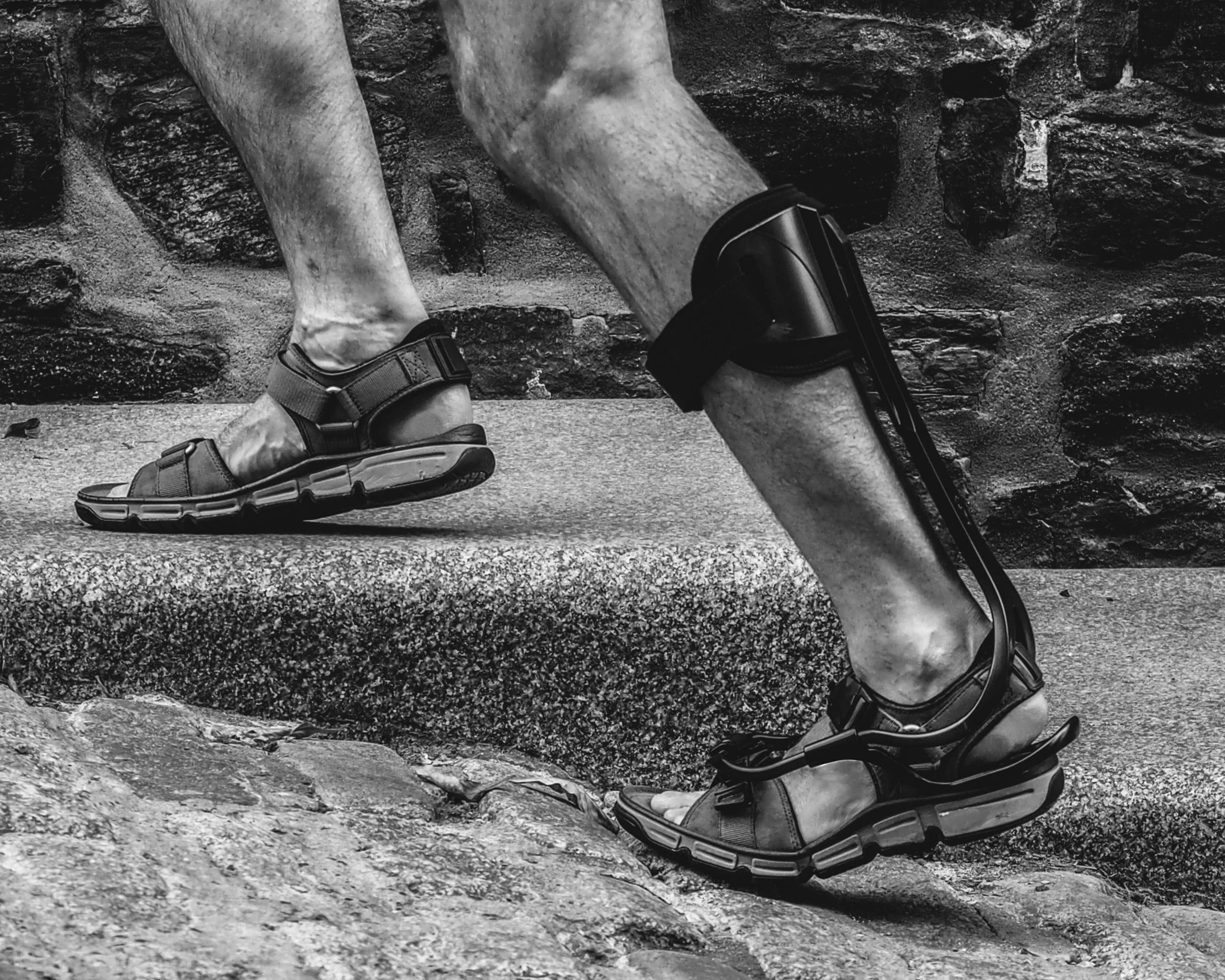 Man walking uphill wearing a Turbomed XTERN ankle-foot orthosis (AFO) for foot drop, providing lightweight, supportive custom orthotic treatment at Limitless Orthotics clinic, Leeds.