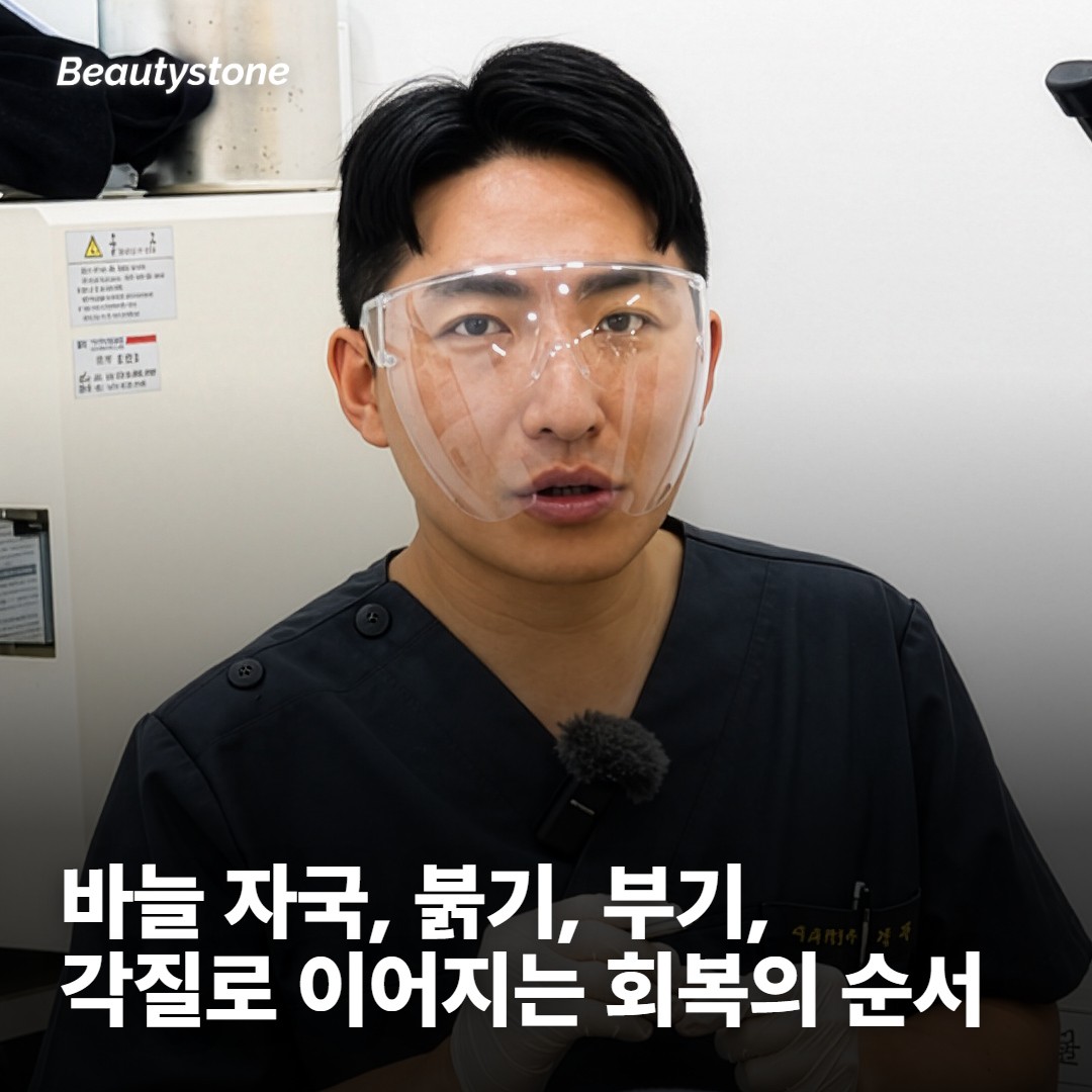 바늘이 지나간 자리에서 순서대로 일어나는 일
