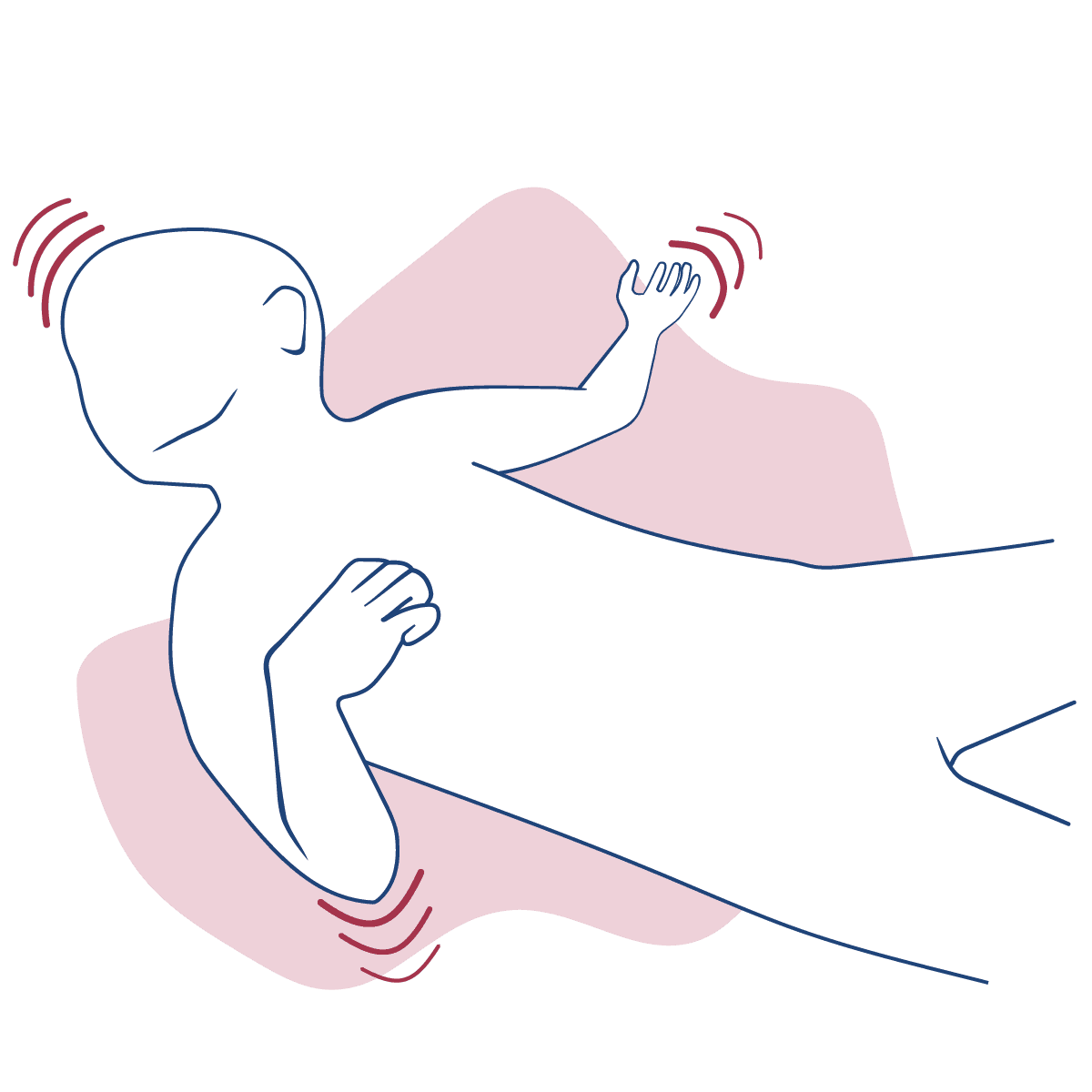 Ilustração mostra criança desenhada em traços azuis, deitada no chão, convulcionando, para ilustrar a epilepsia
