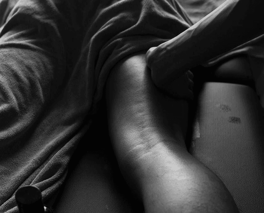 sports massage on hamstring