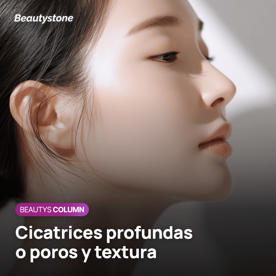 Elegir entre cicatrices profundas o poros y textura