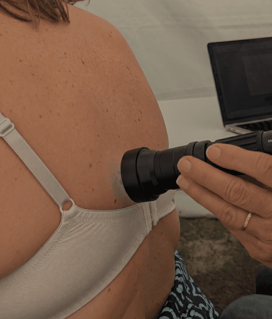 Patient se faisant analyser avec un dermatoscope