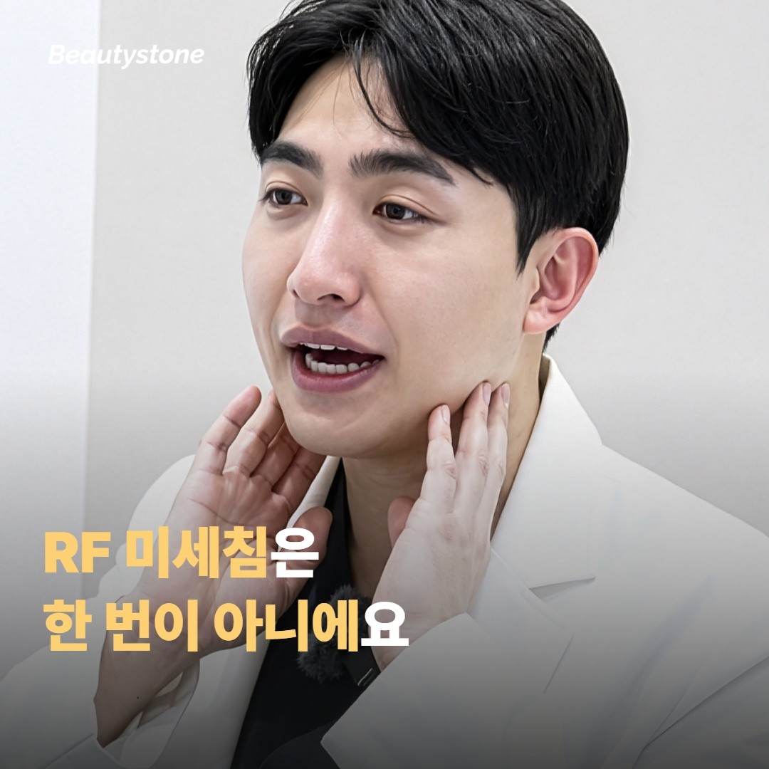 포텐자는 RF 미세침 — 한 번에 끝나는 시술이 아니에요