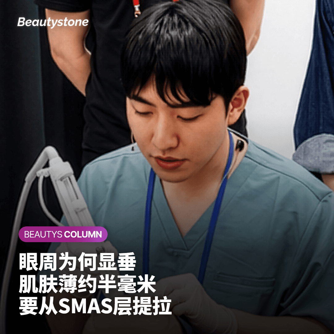 下垂的眼周与眼下凹陷，要用超声波从皮肤深层的SMAS层开始提拉
