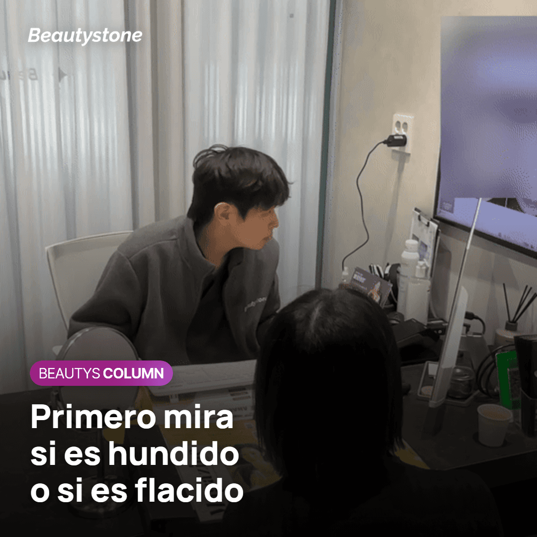 Relleno de volumen a medida para el surco nasogeniano