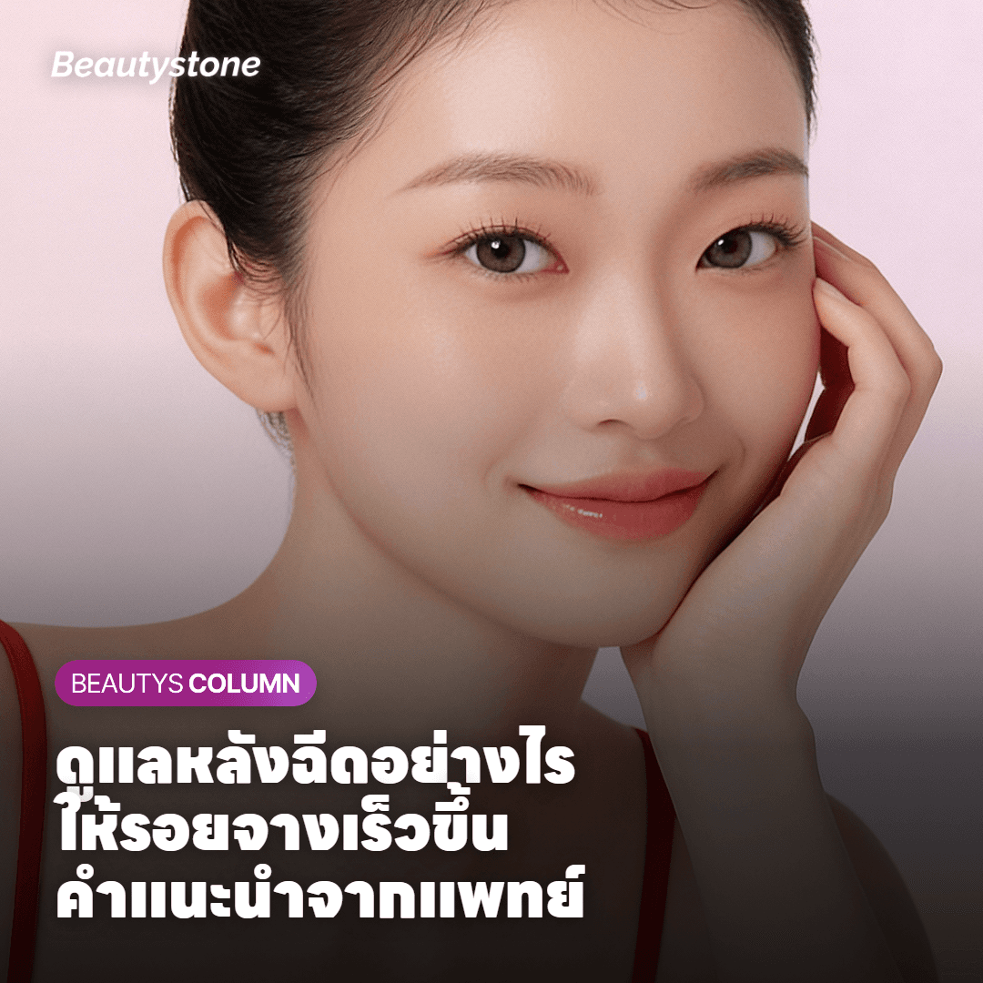 วิธีดูแลตัวเองที่ช่วยให้รอยจางเร็วขึ้น