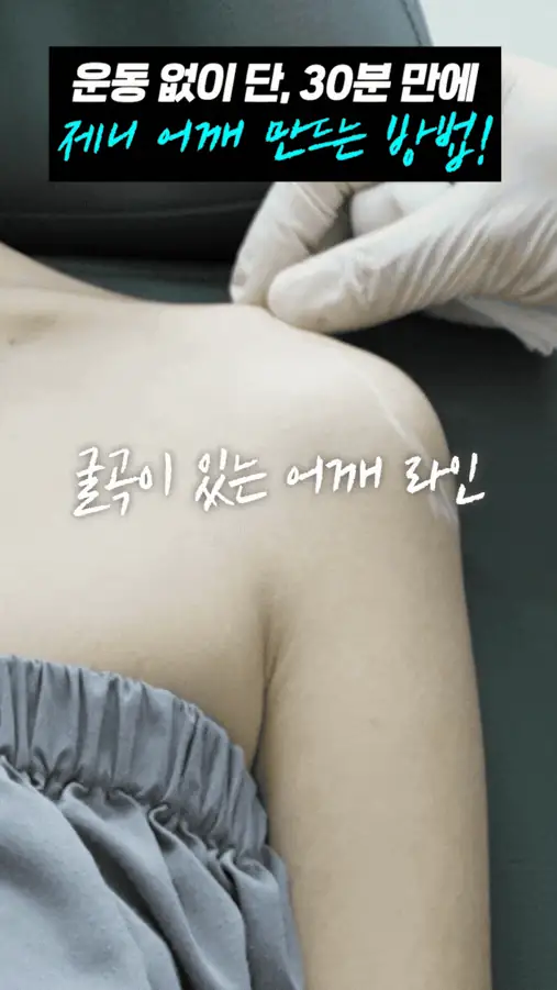 직각 어깨, 타고나야 할까? 쥬베룩글램으로 만드는 어깨 라인