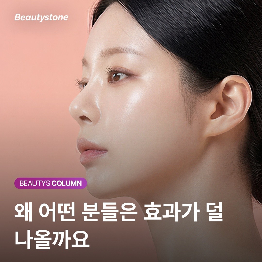 리쥬란 PN 콜라겐 재생 원리