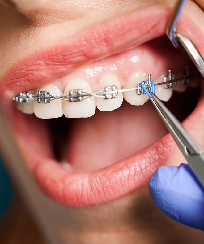 Comprehensive Orthodontic Treatments