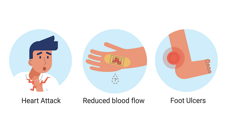 heart attack, reduced blood flow, nerve damage in foot increasing the chances of foot ulcers