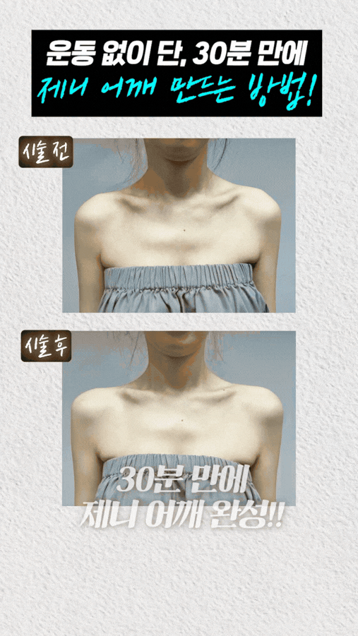 위영진 원장의 실전 노트: 쥬베룩글램으로 완성하는 슬림 어깨 라인