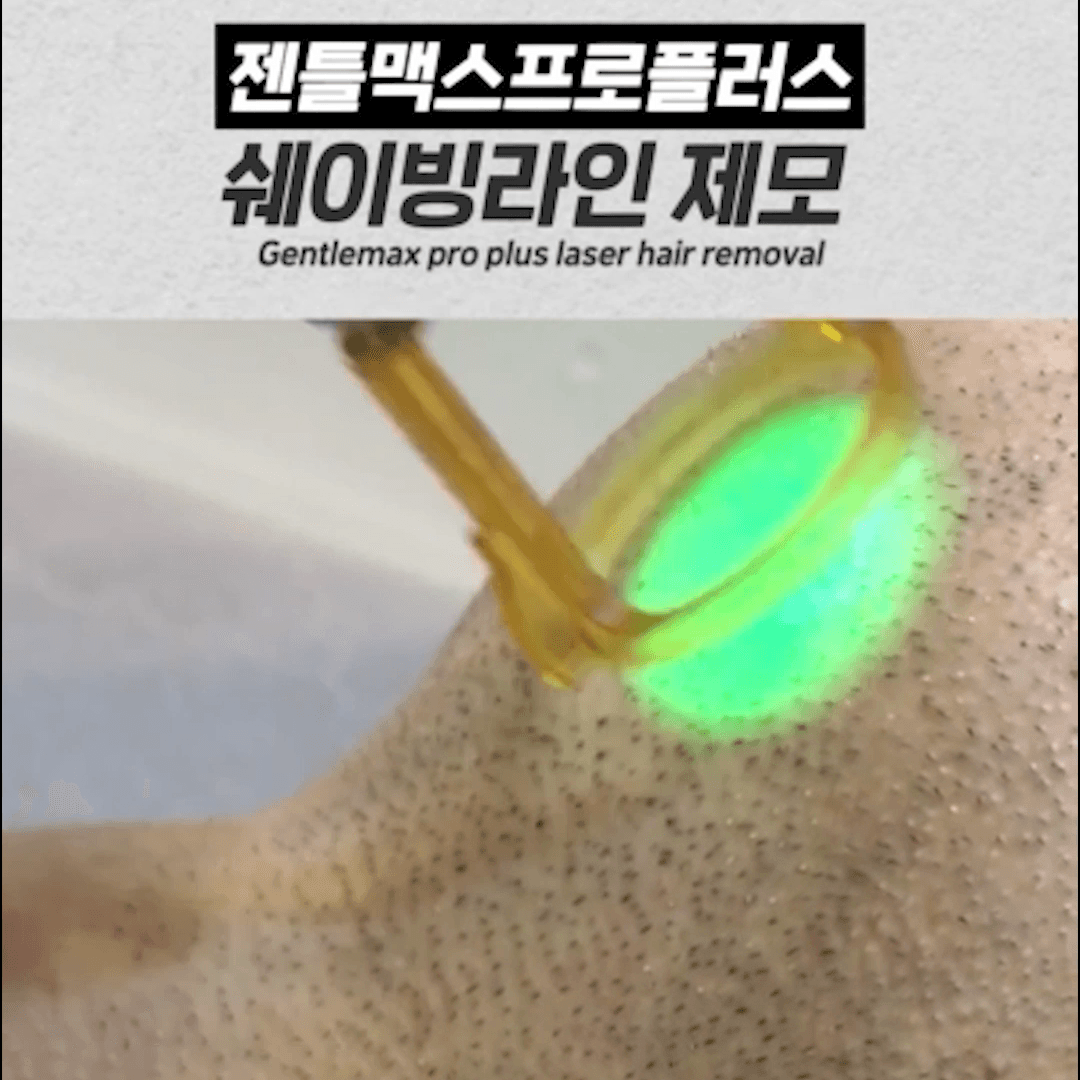 수염 레이저제모 후 모낭염 발생 원리 설명