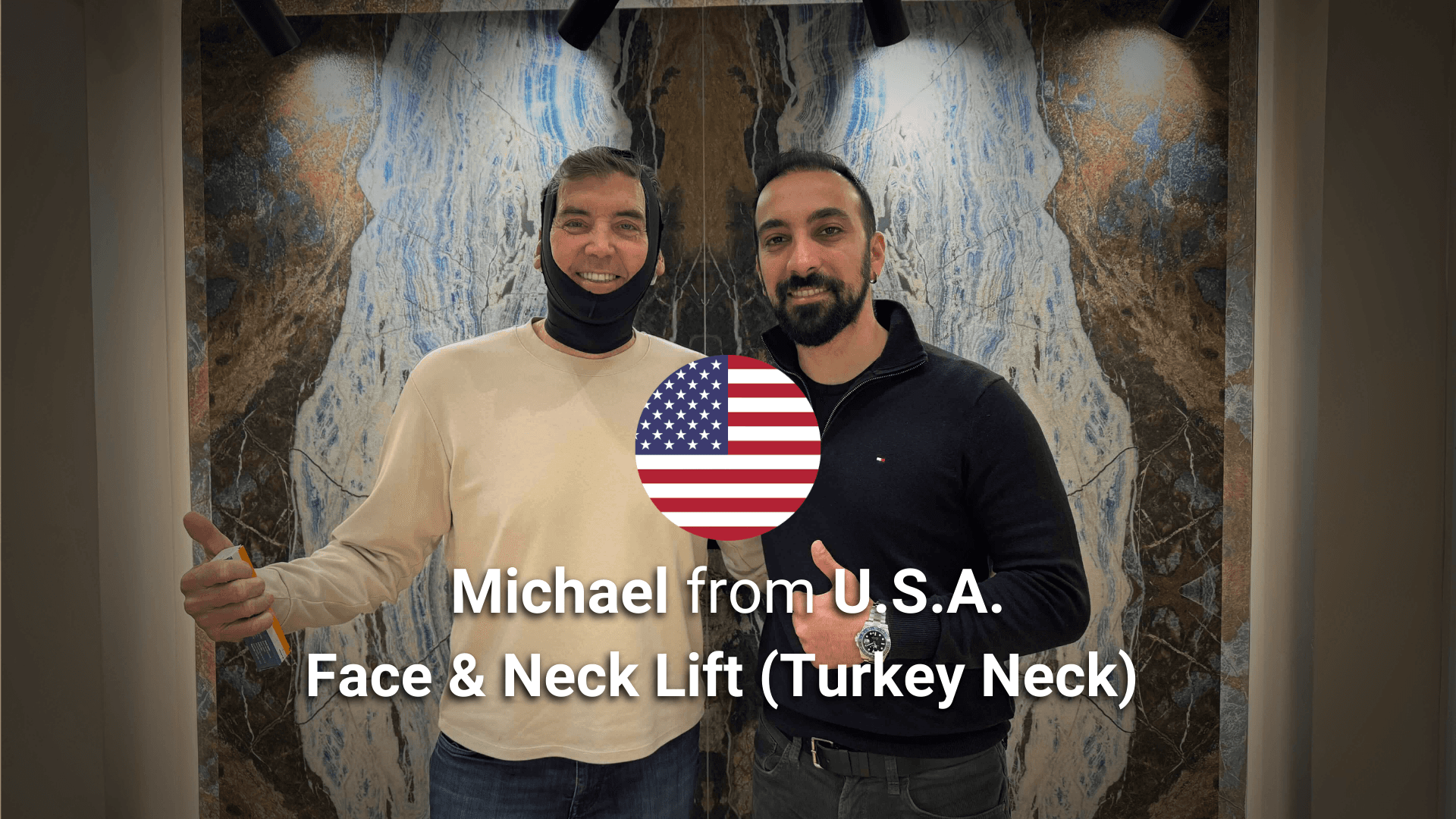 turkey neck surgery and face lift patient in Turkey