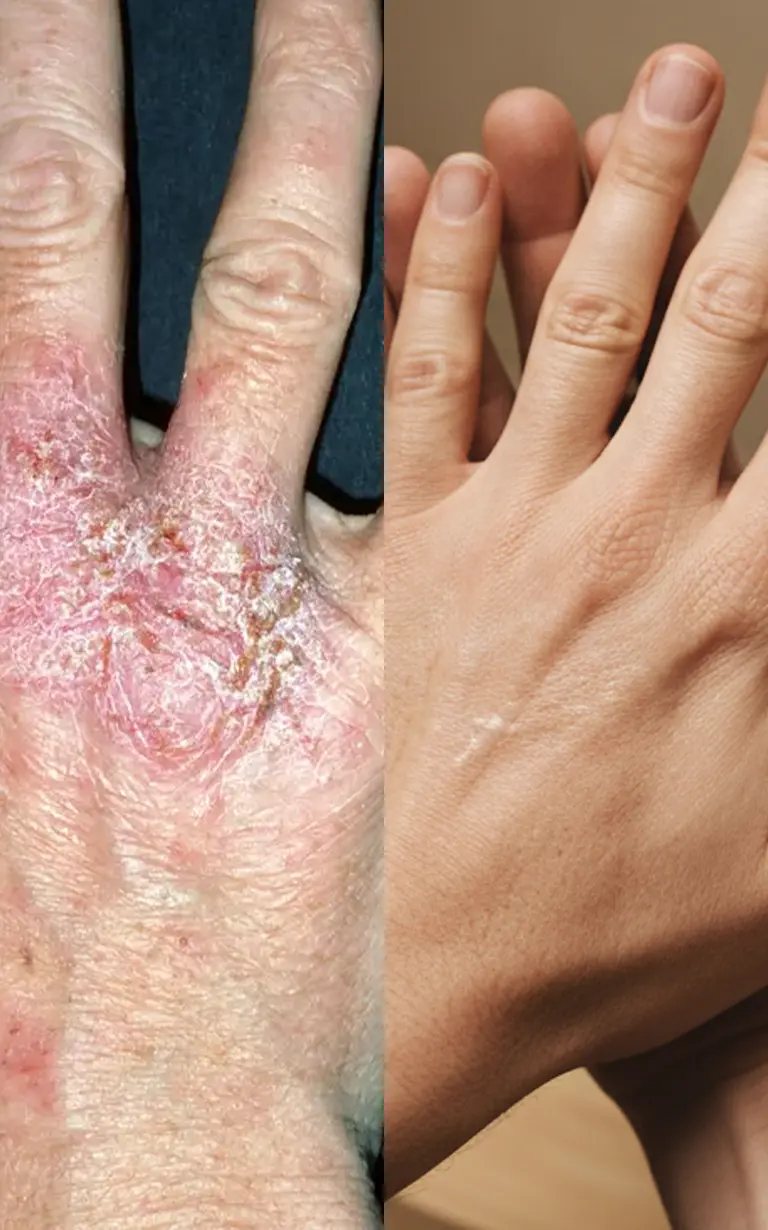 Before and after treatment - face