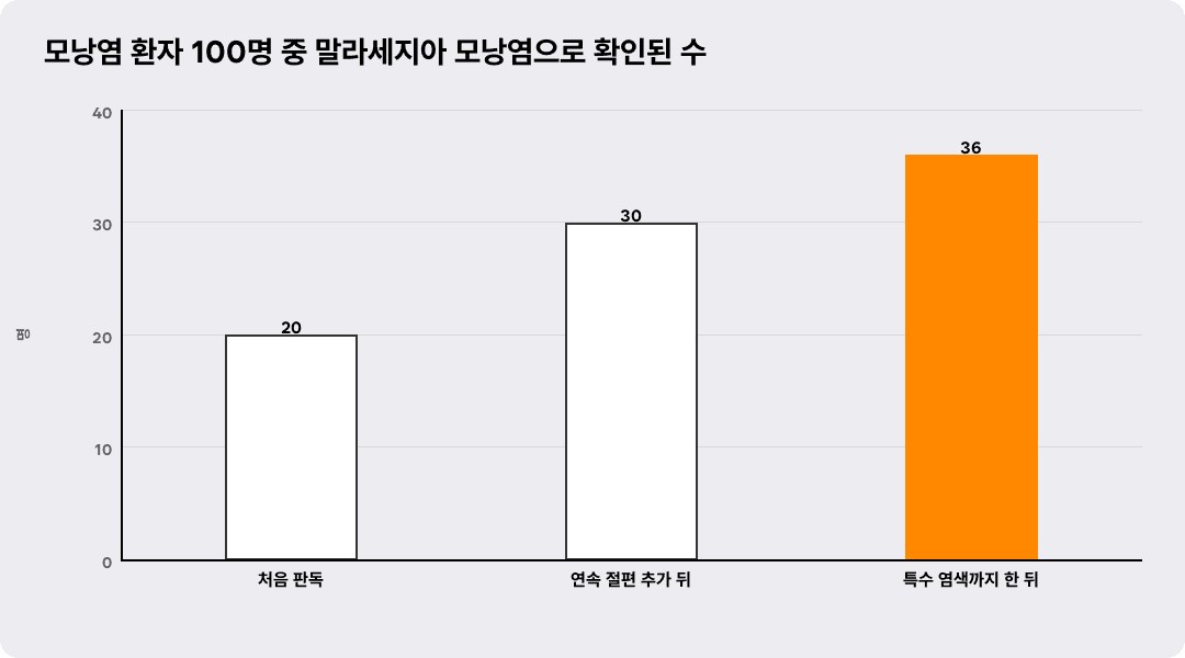 모낭염 환자 100명 중 말라세지아 모낭염으로 확인된 수