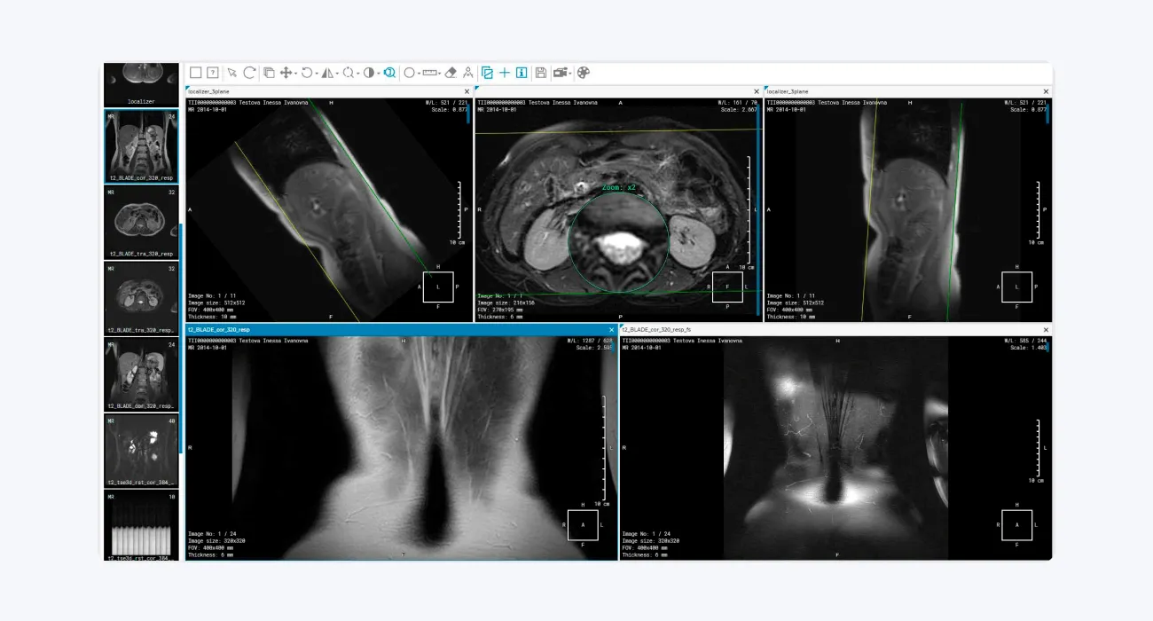 Inobitec: DICOM Viewer