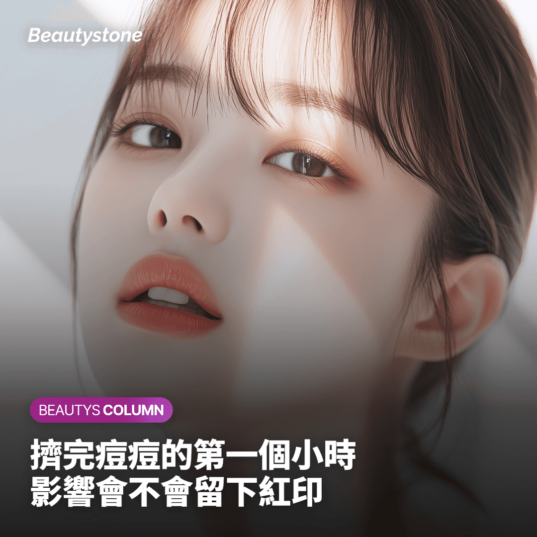 解決22歲患者下巴痘痘困擾的多愛膚科學：擠完後的第一時間是關鍵