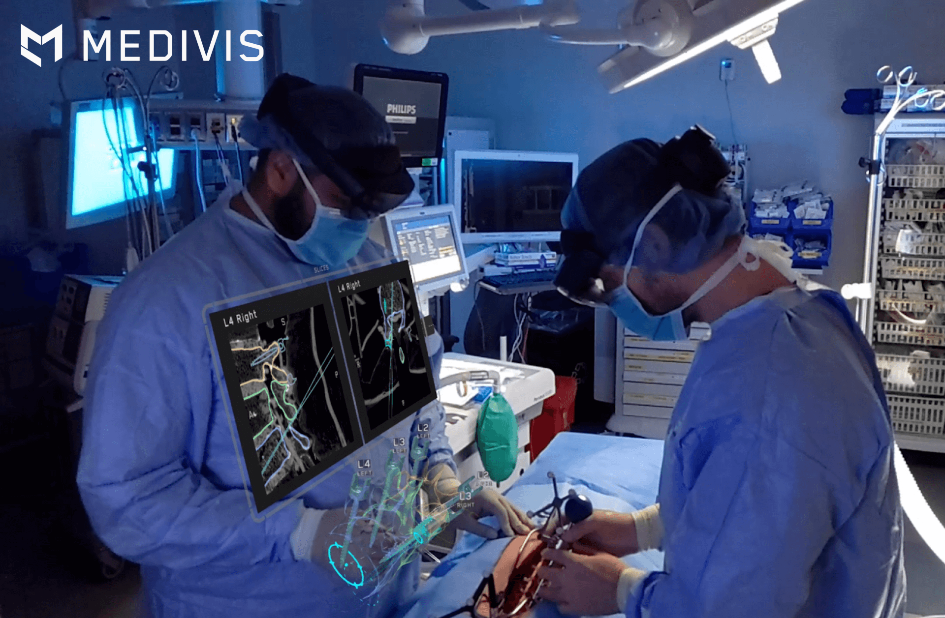 Surgeons in an operating room using Medivis augmented reality technology to view real-time, holographic 3D visualizations of a patient's spine for precision surgical navigation and planning.