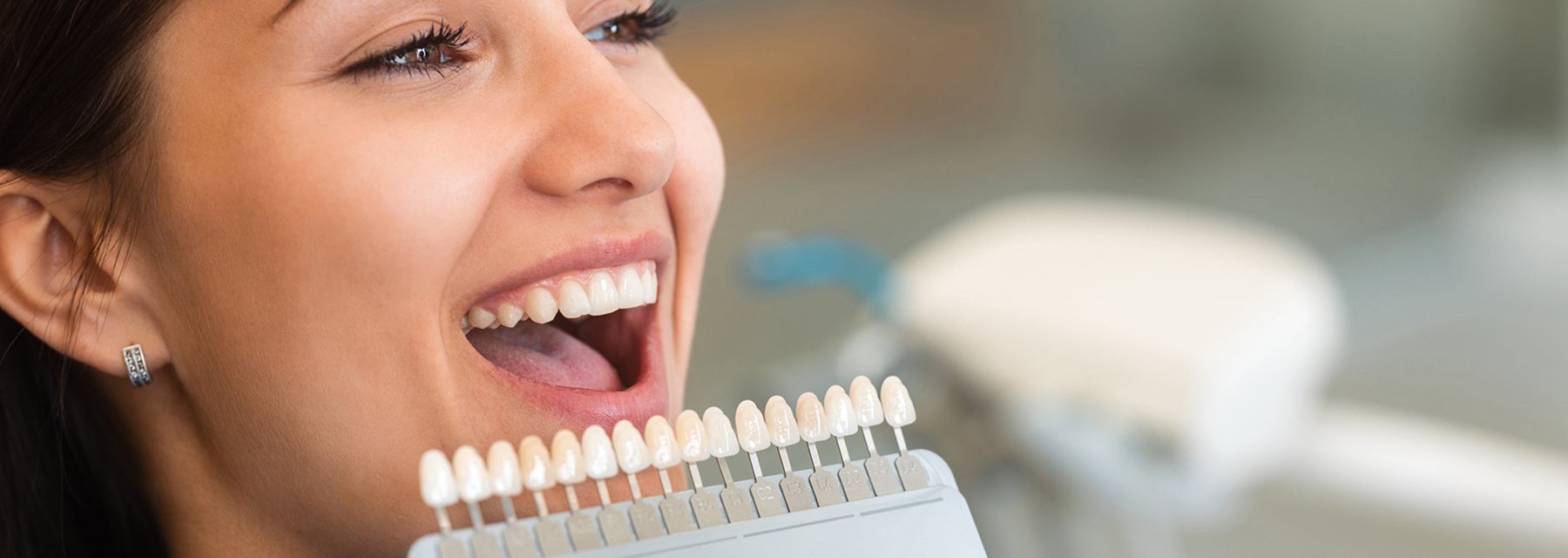 Cosmetic Dentistry in Marietta