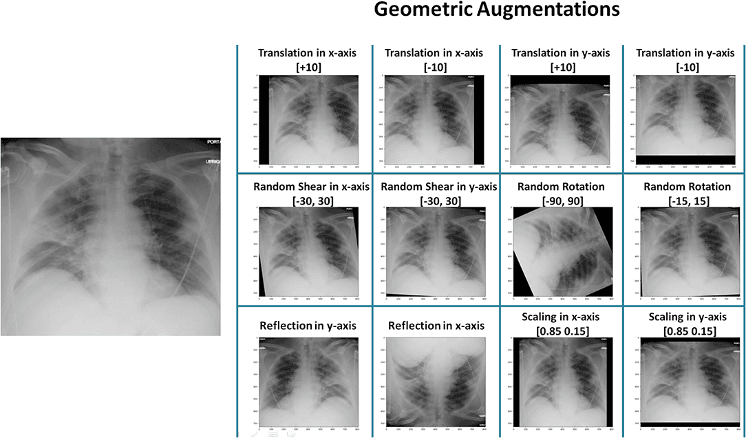 Geometric Augmentations on Xray images of the heart‍