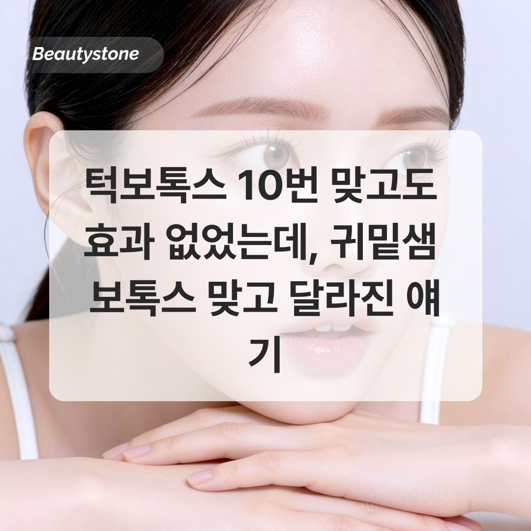 턱보톡스 10번 맞고도 효과 없었는데, 귀밑샘 보톡스 맞고 달라진 얘기