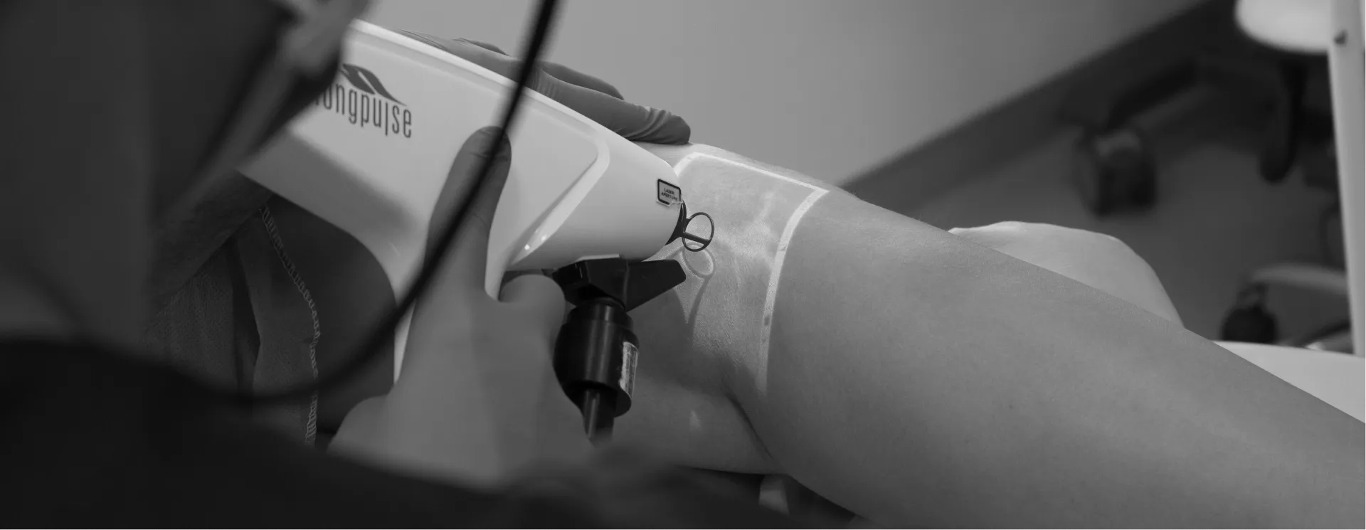 Cirurgião Vascular Utilizando laser para tratamento de varizes nas pernas