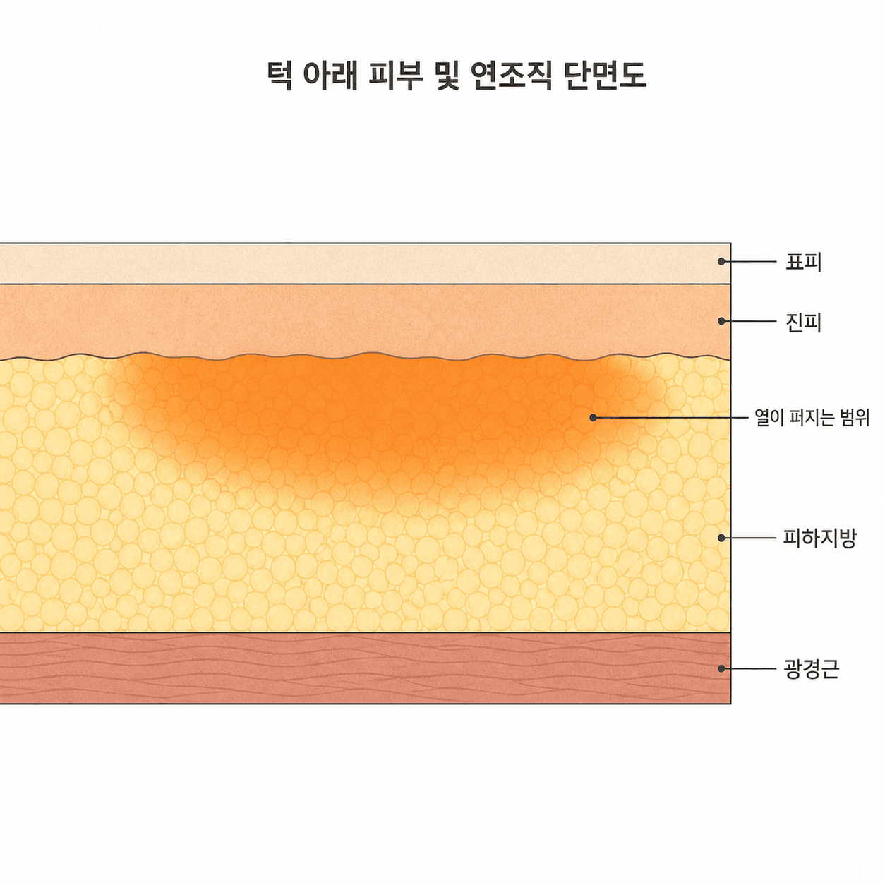 열은 한 층에만 머무르지 않고 지방층과 그 위 진피에 걸쳐 퍼져요.