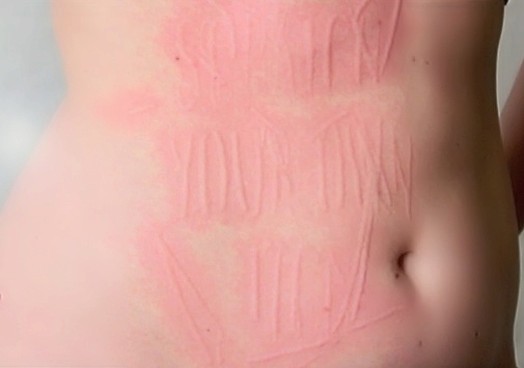 scratch your own itch word scratched on a persons skin