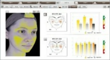 피부_콜라겐벨벳주사_광채분석_인포그래픽_르샤인