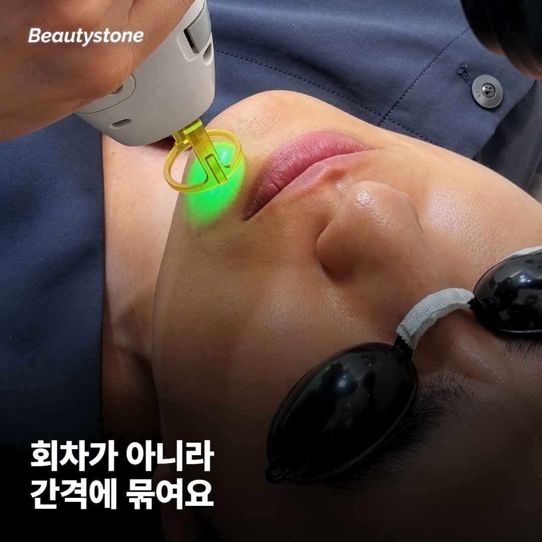 회차가 아니라 간격에 묶인 시술이에요