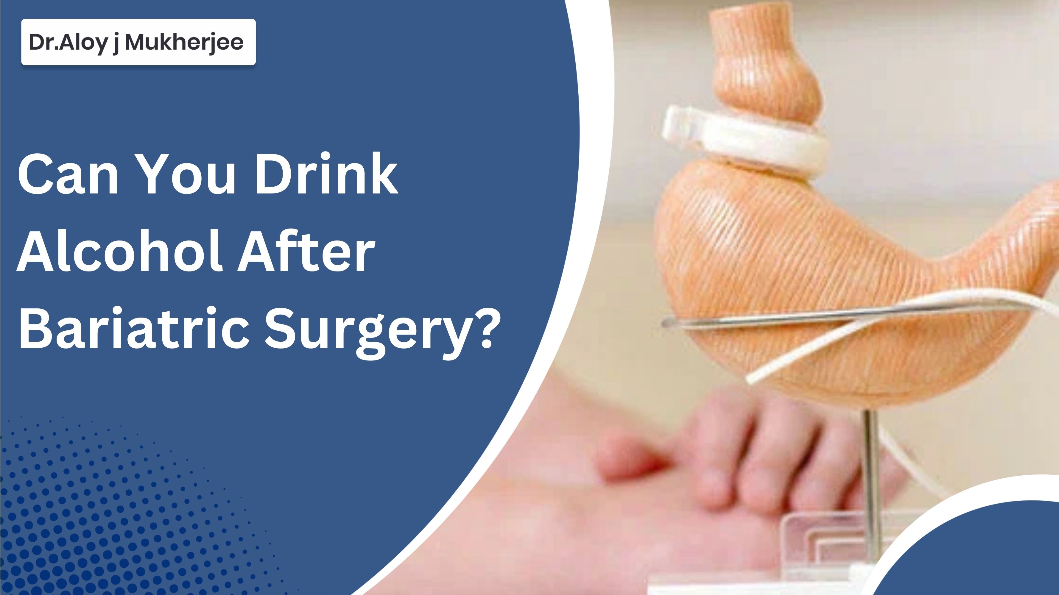 can you drink alcohol after bariatric surgery​