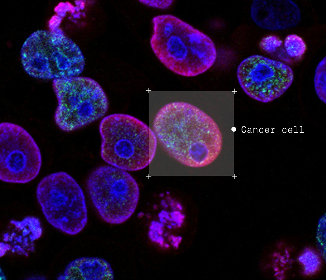 Annotated cancer cells