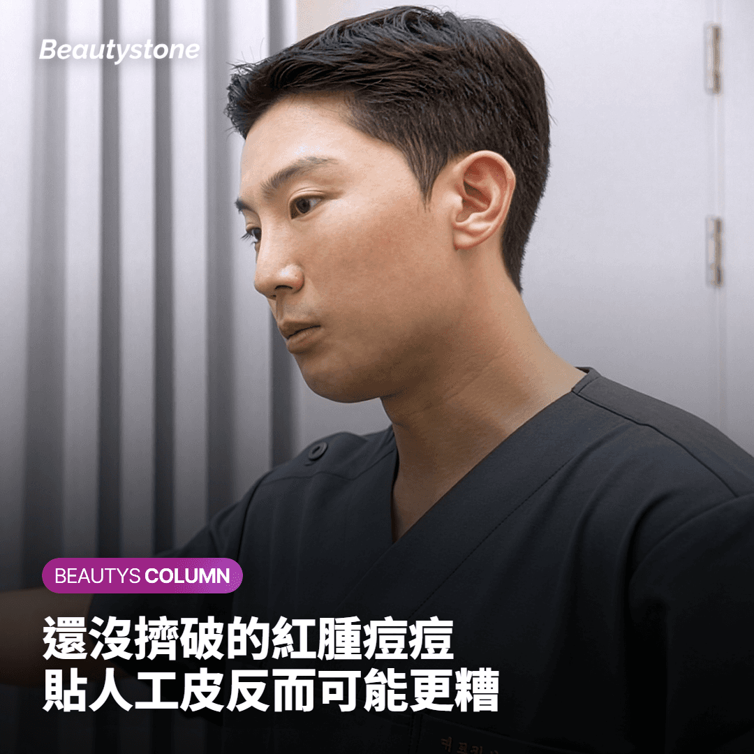 未擠的痘痘貼了反而有害？該貼多愛膚與該停手的時機全解析
