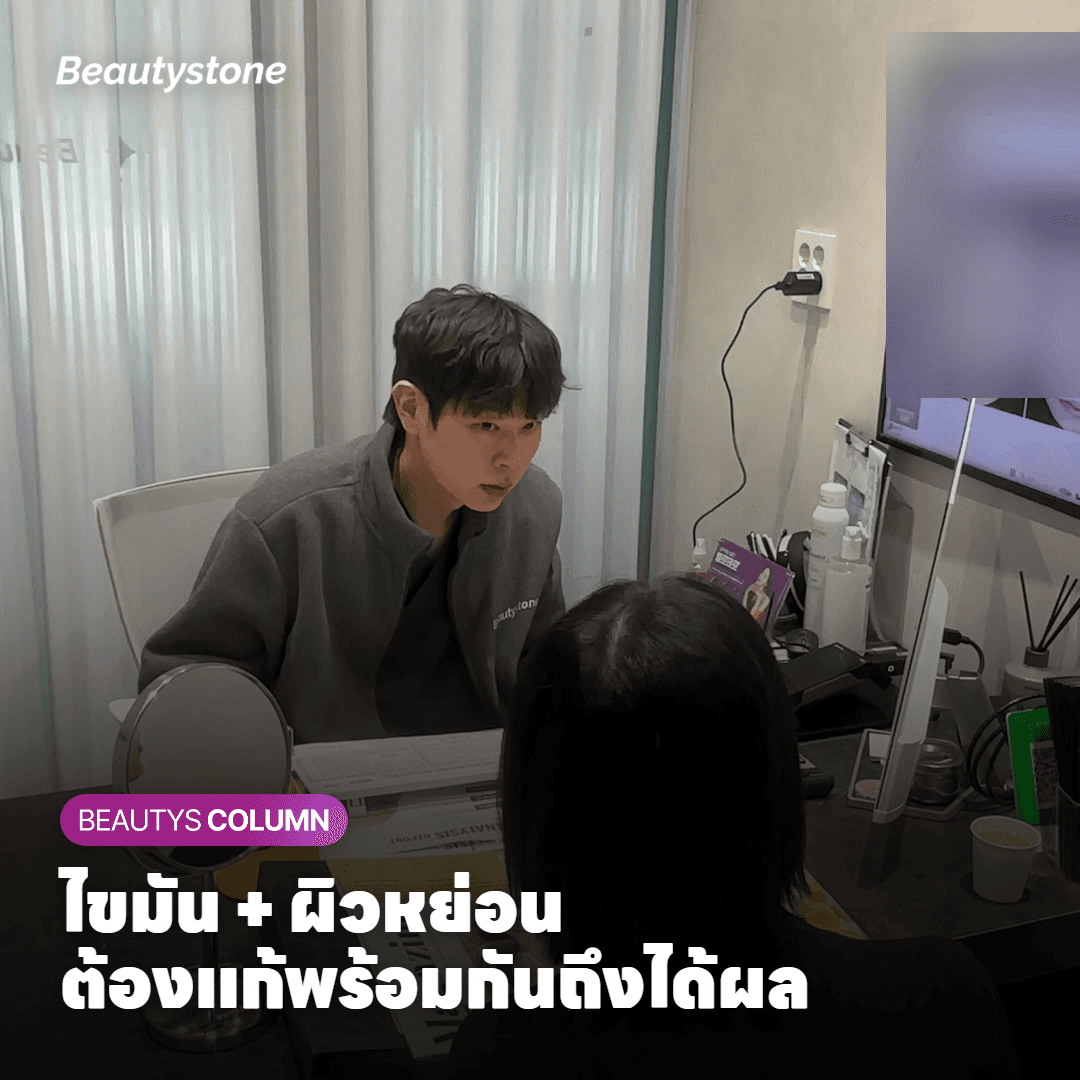แผนภาพแสดงชั้นผิวและชั้นไขมันใต้คางก่อนและหลังการรักษาด้วย Onda