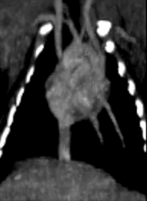 Iodine timepoint 4