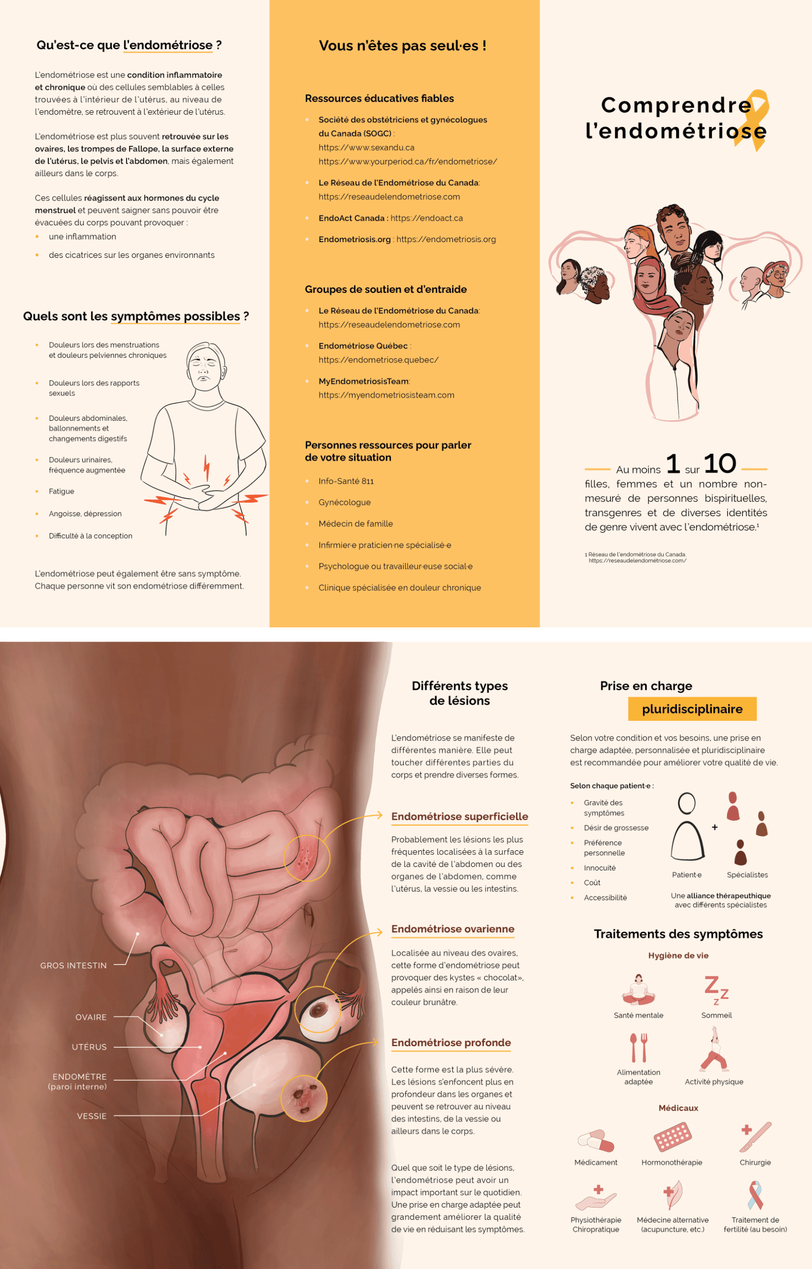 Dépliant sur l'endométriose par l'illustratrice scientifique Élodie Ouellet-Belleau